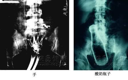 IPB Image