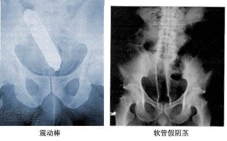 IPB Image