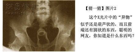 IPB Image