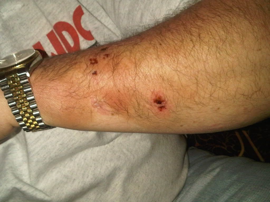 Has your GSD ever bitten someone? German Shepherd Dog Forums