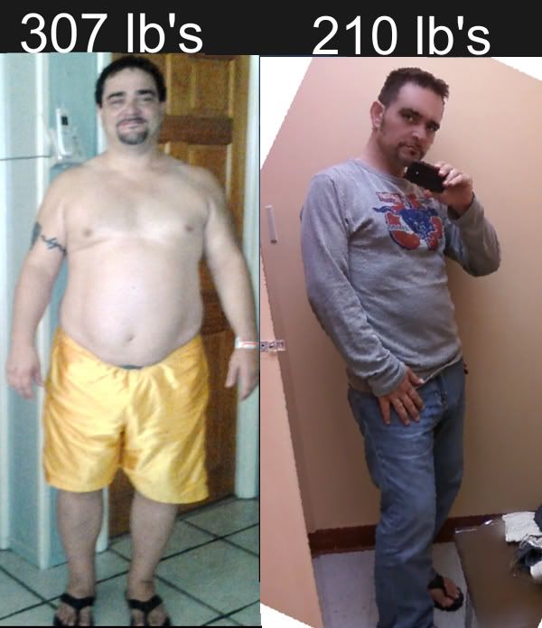 8 months post-op rny gastric bypass 102lb's gone today!! 205lb's now since the photo, 8 months post-op rny gastric bypass 102lb's gone today!! 205lb's now since the photo